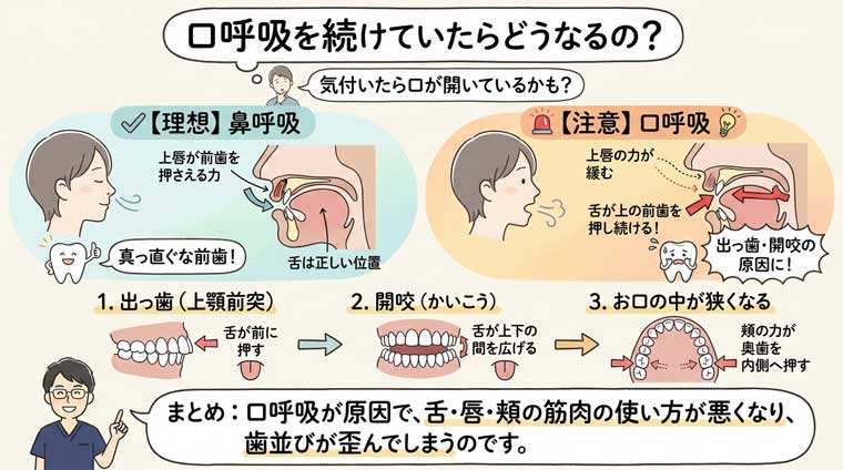 口呼吸を続けていたらどうなるの？の図解