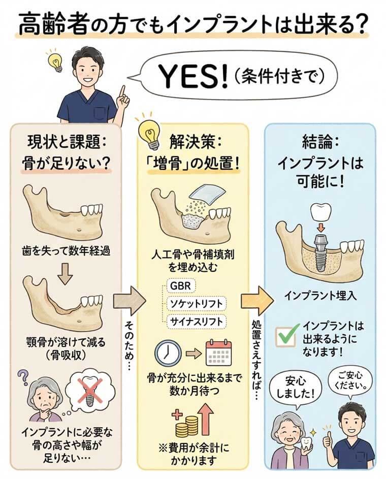 高齢者の方でもインプラントは出来る？の図解