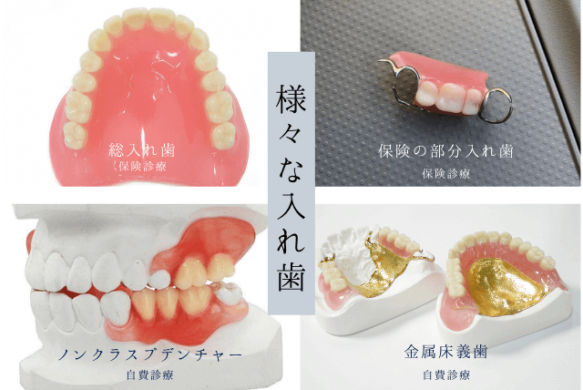 入れ歯の種類