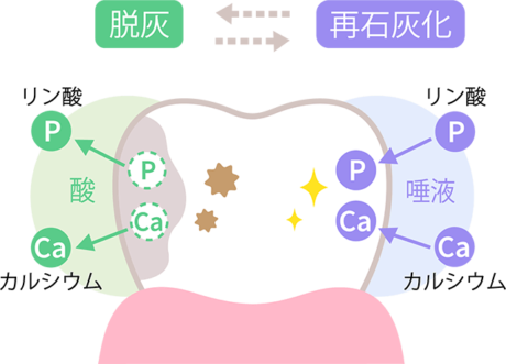 歯の脱灰と再石灰化