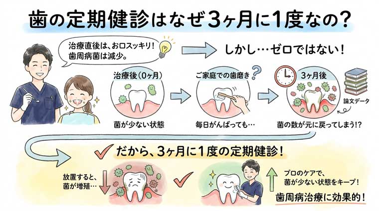 歯の定期健診はなぜ3ヶ月に1度なの？の図解