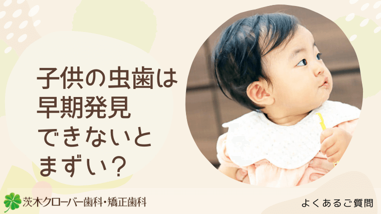 子供の虫歯は早期発見できないとまずい？