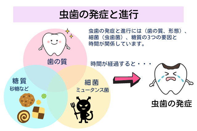 虫歯の発症と進行