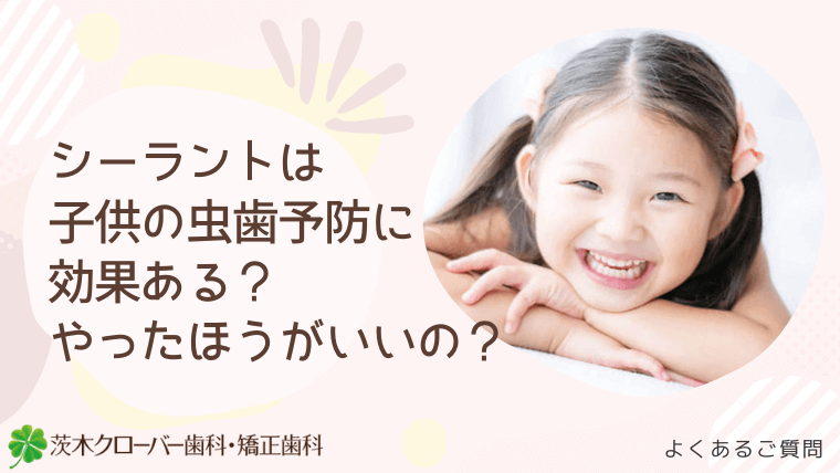 シーラントは子供の虫歯予防に効果ある？やったほうがいいの？