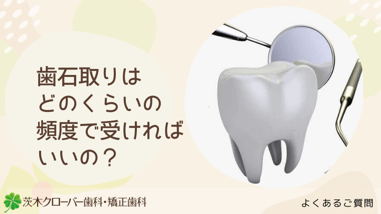 歯石取りはどのくらいの頻度で受ければいいの？