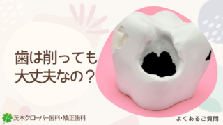 歯は削っても大丈夫なの?