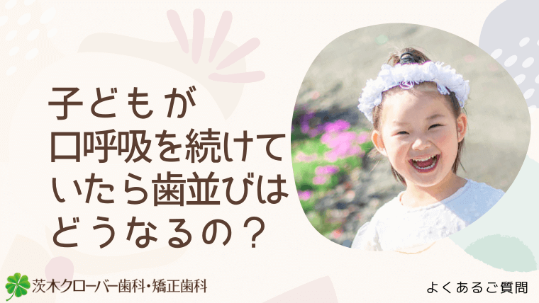 子どもが口呼吸を続けていたら歯並びはどうなるの？