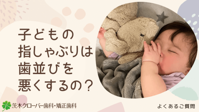 子どもの指しゃぶりは歯並びを悪くするの？