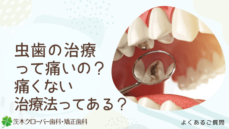 虫歯の治療って痛いの？痛くない治療法ってある？