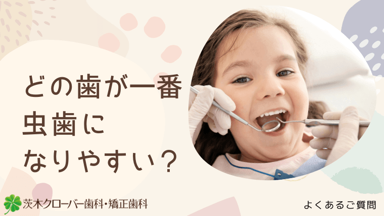 どの歯が一番虫歯になりやすい？