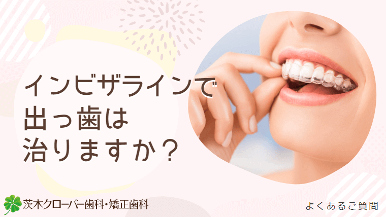 インビザラインで出っ歯は治りますか？