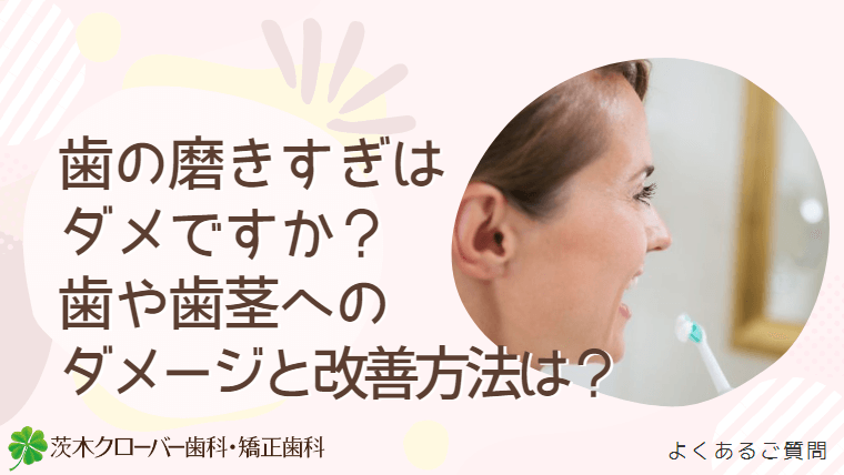 歯の磨きすぎはダメですか？歯や歯茎へのダメージと改善方法について