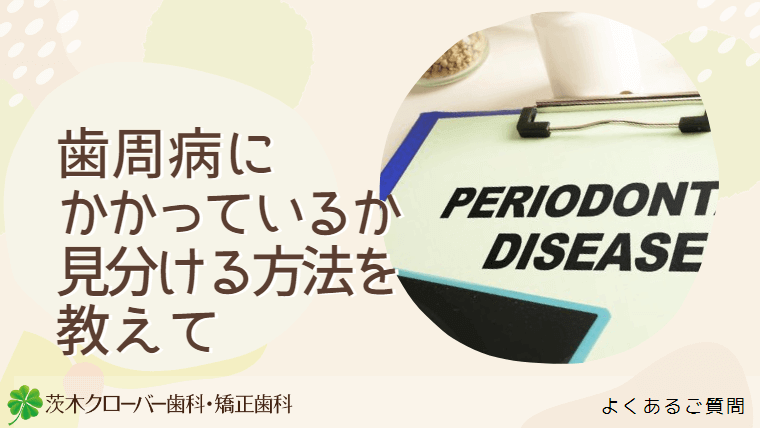 歯周病にかかっているか見分ける方法を教えて