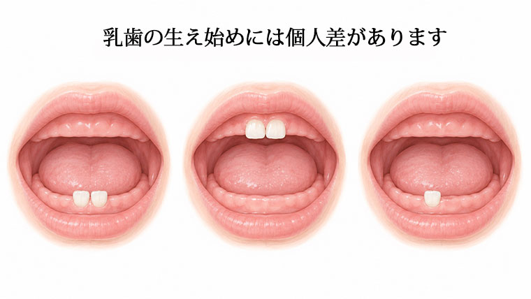 乳歯の生え始め