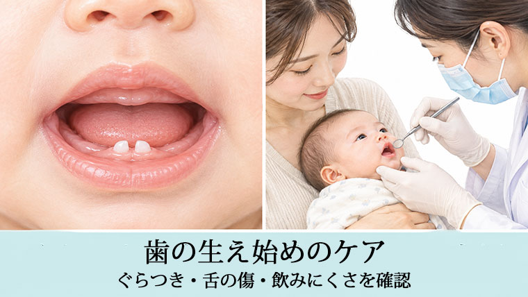 生え始めの乳歯のケア