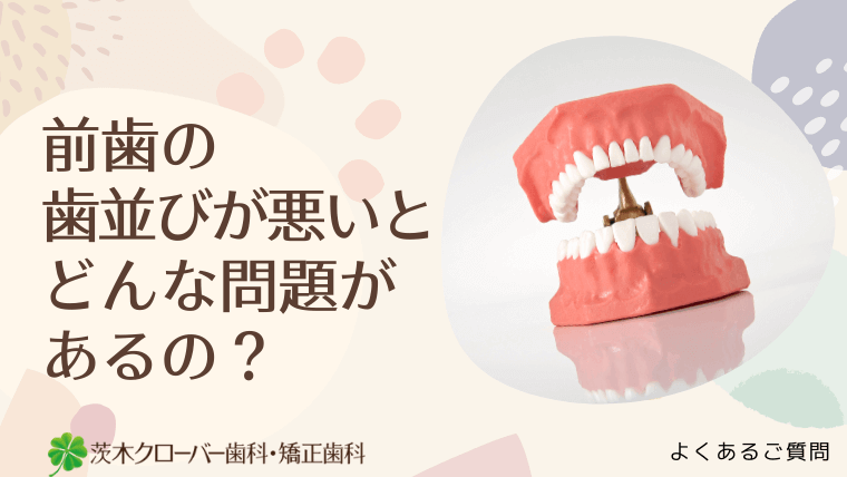 前歯の歯並びが悪いとどんな問題があるの？