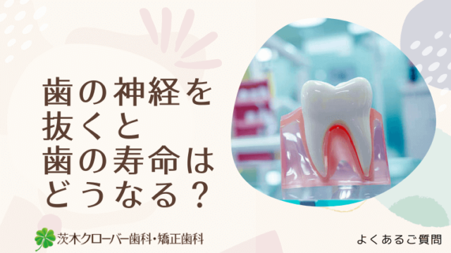 歯の神経を抜くと歯の寿命はどうなる？
