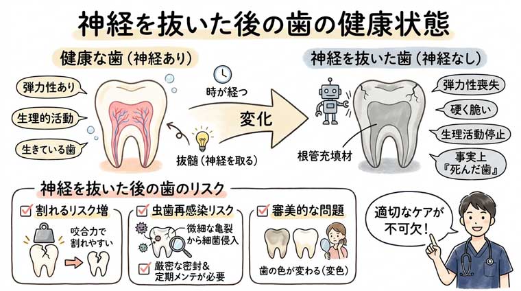 神経を抜いた後の歯の健康状態の図解