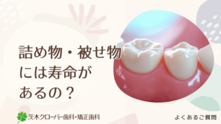 銀歯は二次虫歯になりやすいの？銀歯の寿命は何年？｜茨木