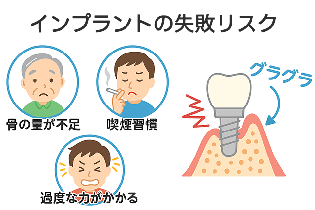 失敗リスク