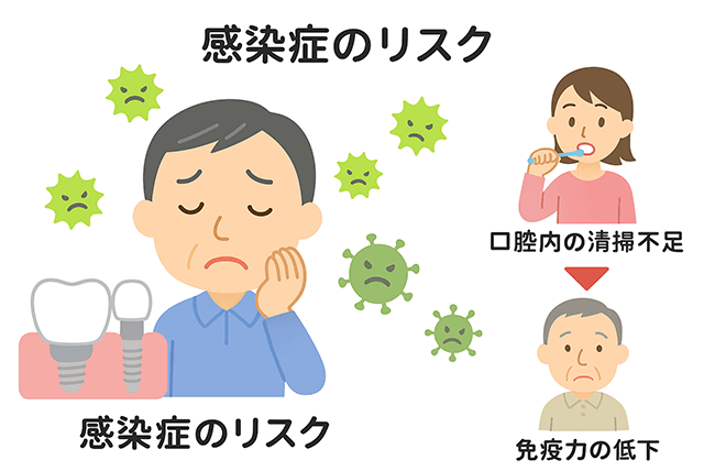 感染症のリスク