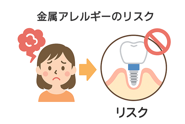 金属アレルギーのリスク