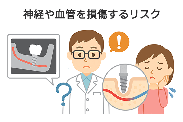 神経・血管の損傷リスク