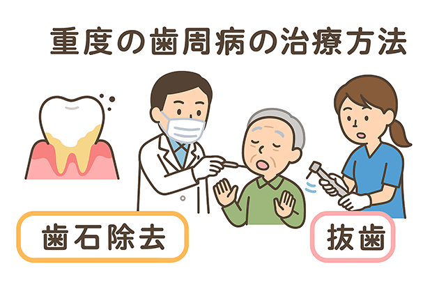 重度の治療方法