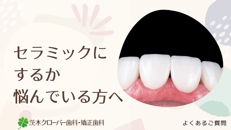 セラミックにするか悩んでいる方へ