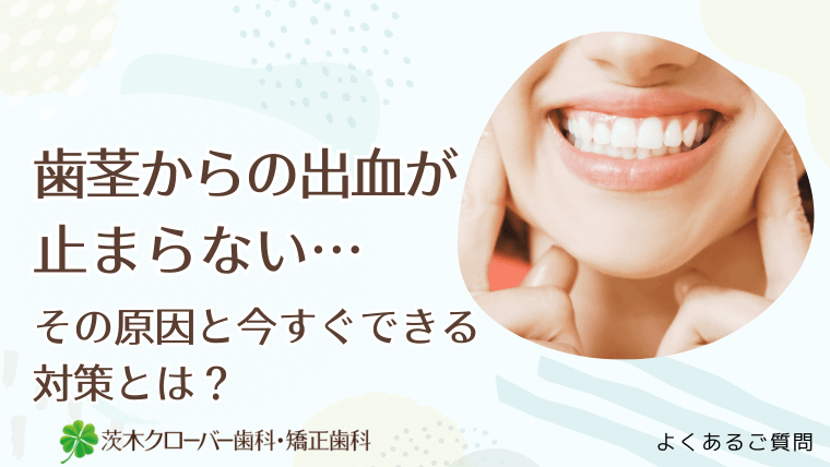 歯茎からの出血が止まらない…