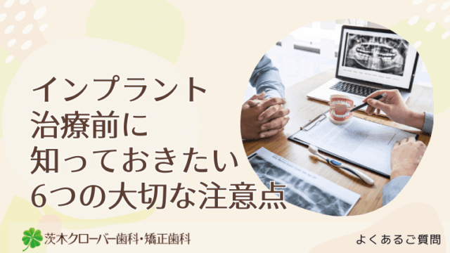 インプラント治療前に知っておきたい6つの大切な注意点
