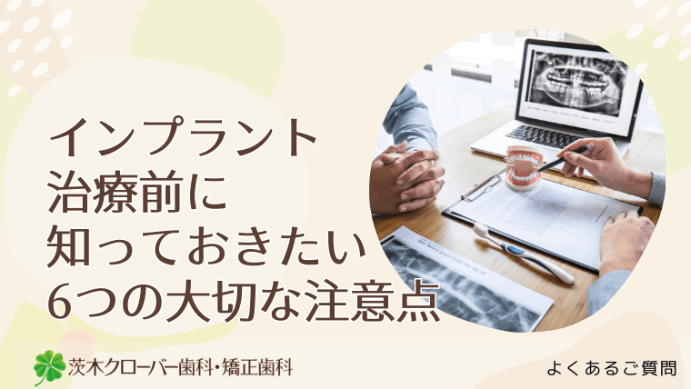 インプラント治療前に知っておきたい6つの大切な注意点