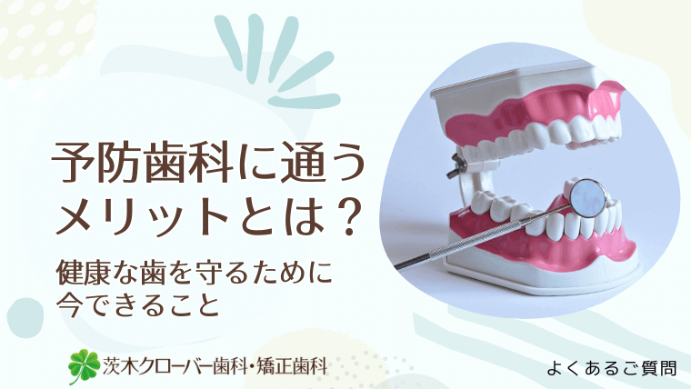 予防歯科に通うメリットとは?