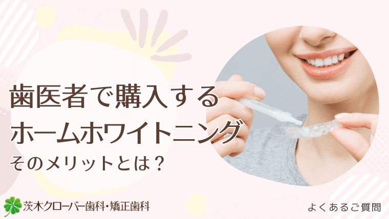 歯医者で購入するホームホワイトニング、そのメリットとは？