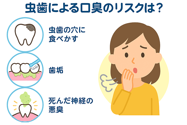 虫歯による口臭のリスク