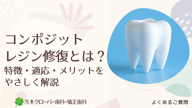 コンポジットレジン修復とは?