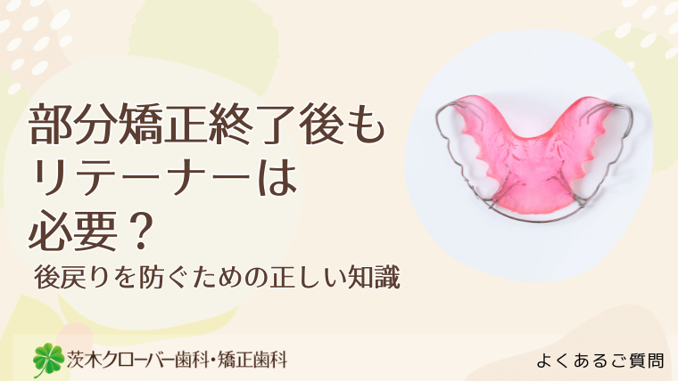 部分矯正終了後もリテーナーは必要？
