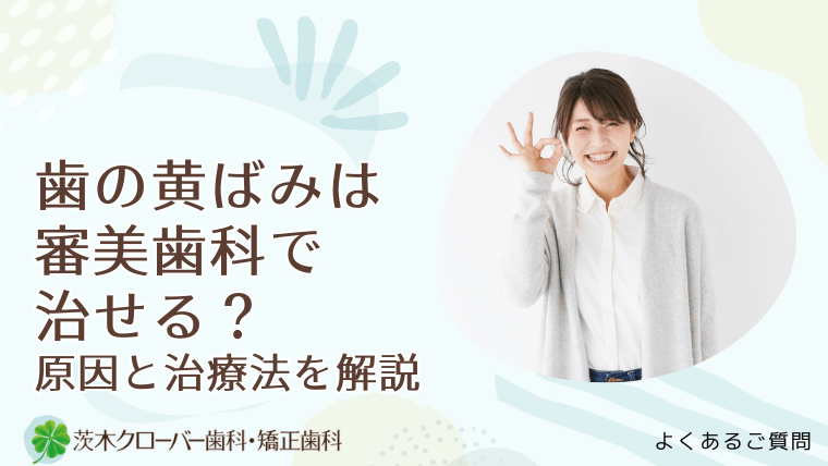 歯の黄ばみは審美歯科で治せる？原因と治療法を解説