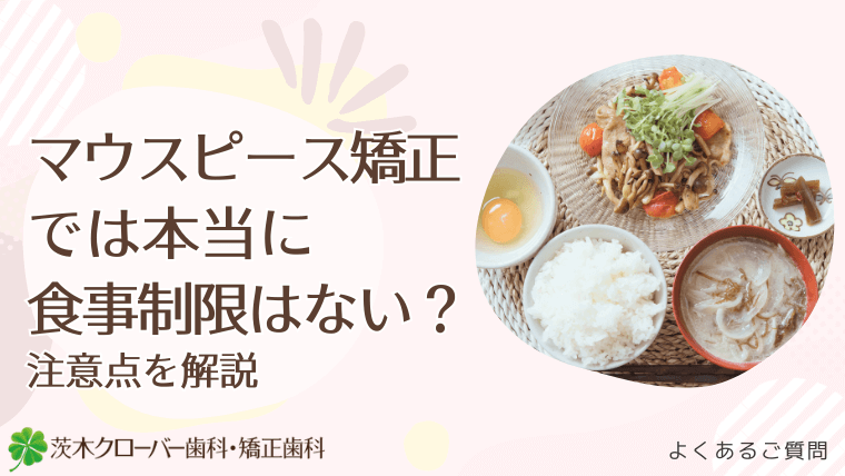 マウスピース矯正では本当に食事制限はない？