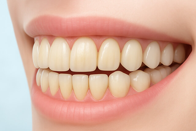 歯の黄ばみ