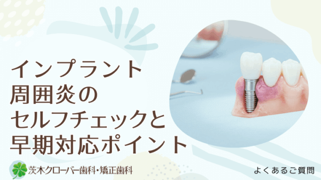 インプラント周囲炎のセルフチェックと早期対応ポイント