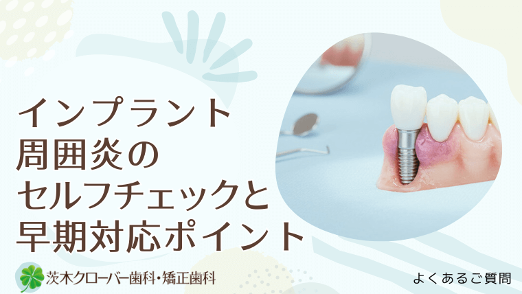 インプラント周囲炎のセルフチェックと早期対応ポイント