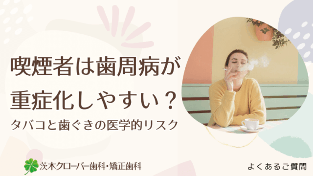 喫煙者は歯周病が重症化しやすい？
