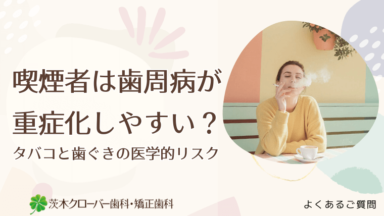 喫煙者は歯周病が重症化しやすい?