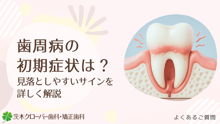 歯周病の初期症状は?見落としやすいサインを詳しく解説