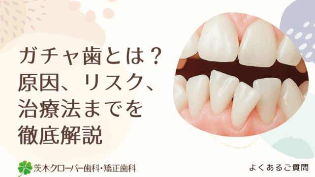 ガチャ歯とは？原因、リスク、治療法までを徹底解説