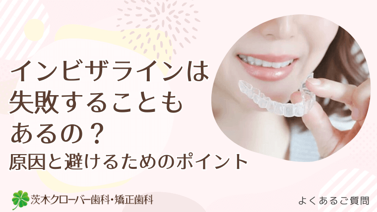 インビザラインは失敗することもあるの？原因と避けるためのポイント