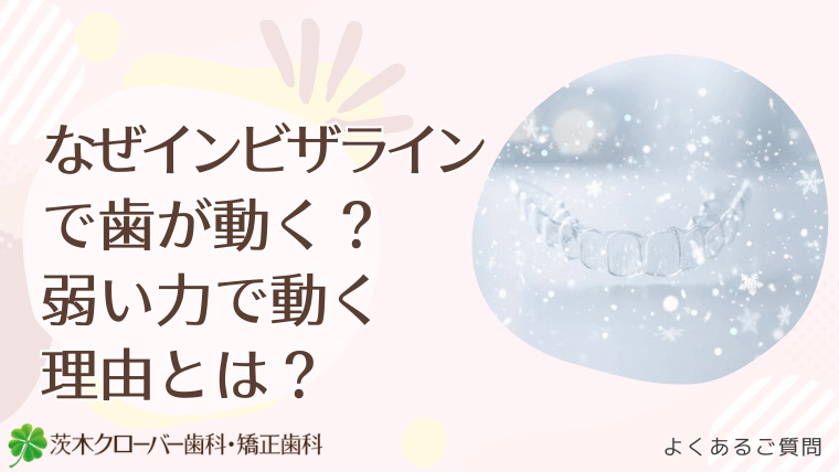 なぜインビザラインで歯が動く？弱い力で動く理由とは？