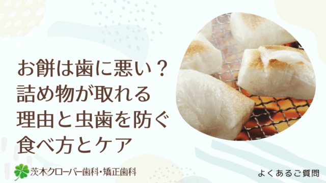 お餅は歯に悪い？詰め物が取れる理由と虫歯を防ぐ食べ方とケア