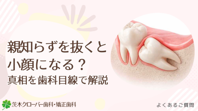 親知らずを抜くと小顔になる？真相を歯科目線で解説